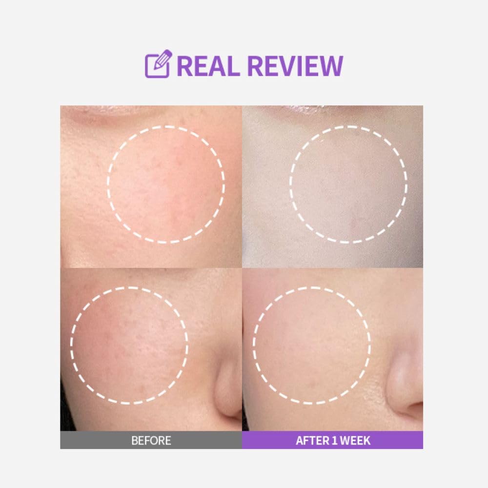 SUNGBOON EDITOR Meoru Podo VitaC Dark Spot Ampoule 30ml