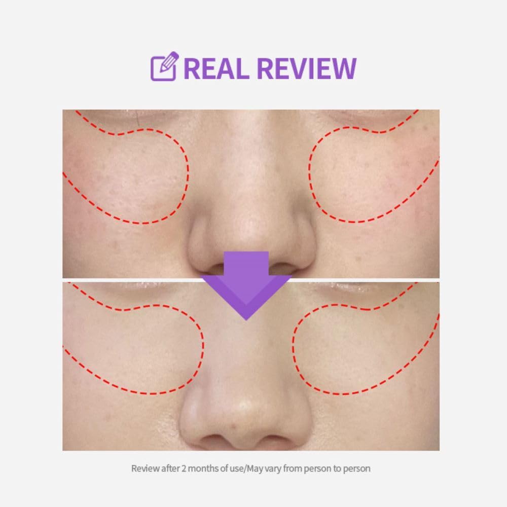 SUNGBOON EDITOR Meoru Podo VitaC Dark Spot Pad 60EA