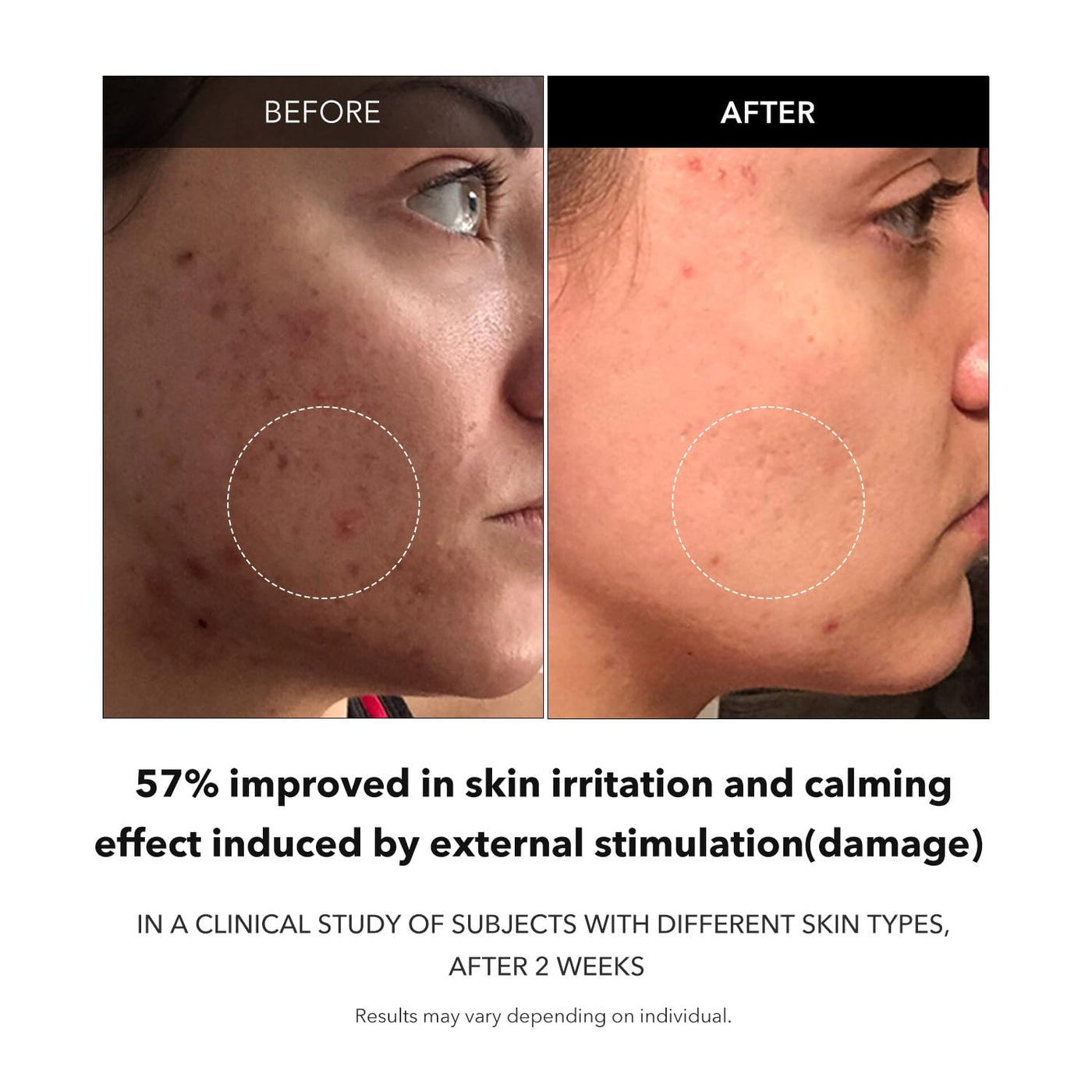 APRILSKIN Carrotene Clarifying Serum 37ml