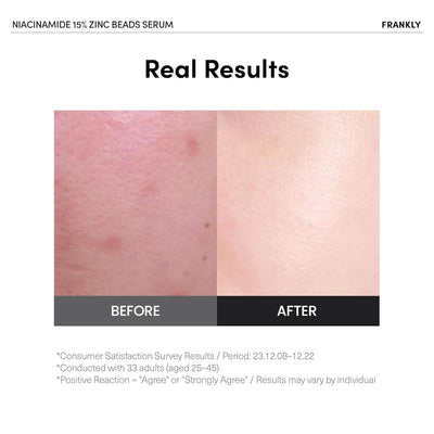 FRANKLY Niacinamide 15% Zinc Beads Serum 30ml