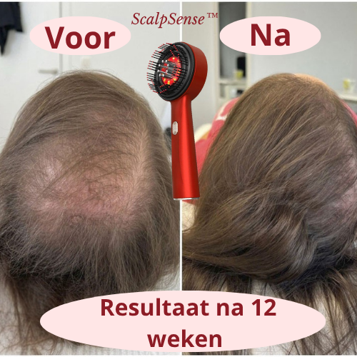 ScalpSense™ - Stimuleer de doorbloeding. Activeer de haargroei.